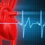 Clasificación de las arritmias cardiacas