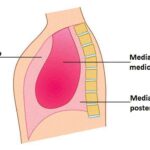 ¿Cuáles son alteraciones frecuentes del mediastino?