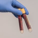 ¿De que elementos se compone la sangre