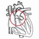 ¿Cómo es la válvula pulmonar?