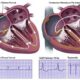 ¿Qué son las vías de conducción accesorias del corazón?