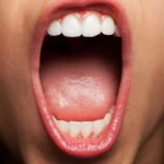 ¿Cuáles son las infecciones frecuentes de la cavidad oral?