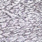 ¿Qué son las fibras reticulares del tejido conjuntivo?