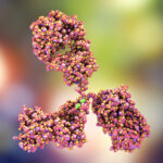 ¿Qué es la glomerulopatía por IgA?