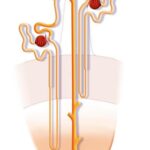 ¿Cuáles son las causas de necrosis tubular aguda?