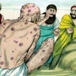 Repaso rápido: Lepra (enfermedad de Hansen)