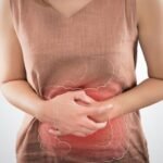 ¿Cuáles son las manifestaciones del síndrome de colon irritable?