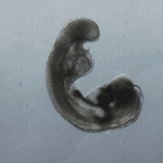 ¿A qué edad gestacional se forma el intestino delgado?