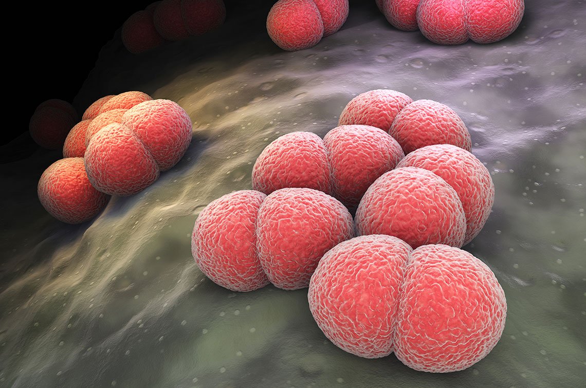 ¿Qué es la meningitis meningocóccica?