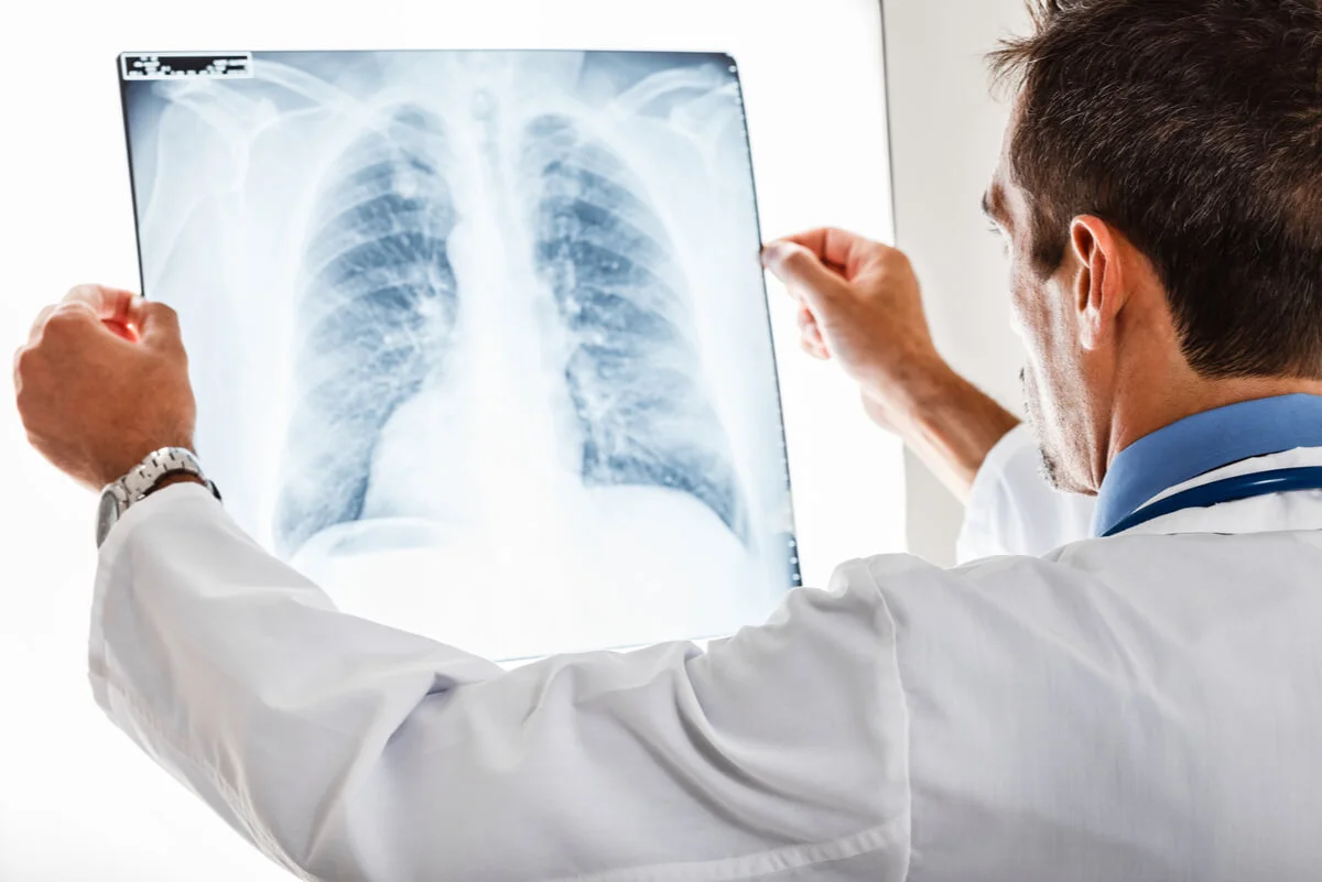 Enfermedades pulmonares por exposiciones laborales