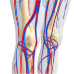 Enfermedad oclusiva arterial femoral y popitlea