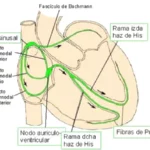 Retraso de la transmisión eléctrica de las aurículas a los ventrículos.