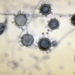 ¿Qué es el Histoplasma capsulatum?