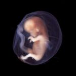 ¿Como se clasifica el aborto?