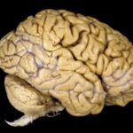 ¿Cuanto pesa el cerebro?