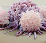 ¿Qué son las células NK?