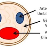 ¿Qué es la gelatina de Wharton?