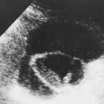 ¿Por que se forma un biloma?