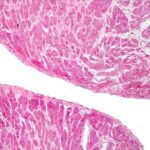 ¿Qué es el endocardio?