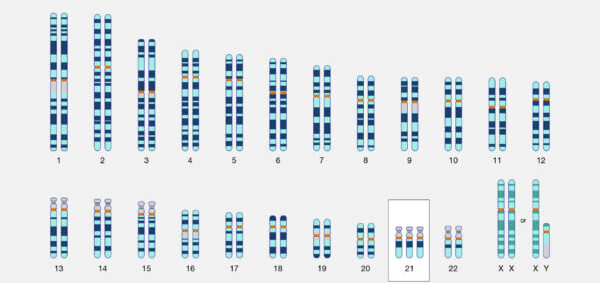 Clasificación de las aberraciones cromosómicas numéricas