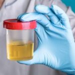 Examen general de orina