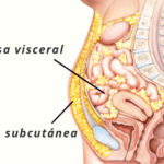 La obesidad visceral es causa de resistencia a la insulina