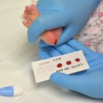 ¿Qué es el tamiz neonatal?