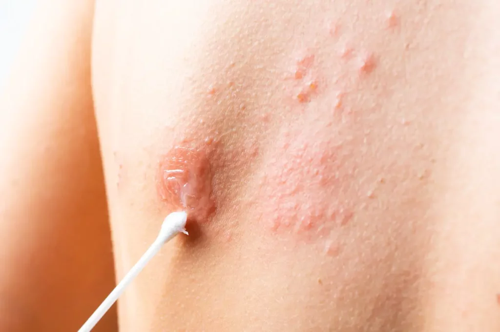 ¿Cuáles son las enfermedades dermatológicas más frecuentes?