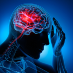 ¿Qué es el accidente vascular cerebral?