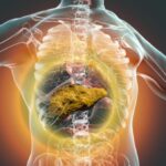 Clasificación de la cirrosis hepática de acuerdo a sus causas