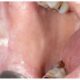 ¿Cuáles son las paredes de la cavidad oral?
