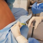 Administración intratecal de fármacos