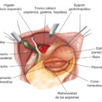 Relaciones anatómicas del estómago