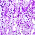 Regeneración de células gástricas