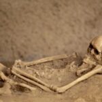 Primeros procedimientos quirúrgicos de la humanidad