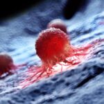 ¿Qué es el cáncer?