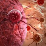 ¿Qué es la heterogeneidad del cáncer?