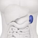 ¿Qué es la esplenectomía?