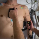 ¿Qué es la cardioversión eléctrica?