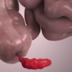 Clasificación histopatológica de la apendicitis