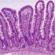 ¿Cuál es la función de la mucosa intestinal?