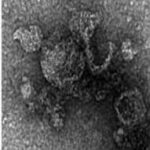 ¿Qué es la ferroptosis?