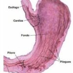 Características de la mucosa en la región del cardias