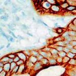 ¿Cuantas citoqueratinas se expresan en las células epiteliales?