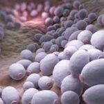 Factores de riesgo para Candidosis invasora