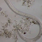 ¿En que parte del mundo es común la anquilostomiosis?