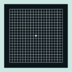 ¿Qué es la rejilla de Amsler?