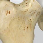 Clasificación de los forámenes nutricios de los huesos