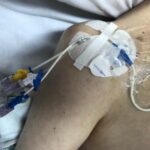 Complicaciones mecánicas de la colocación de catéter venoso central