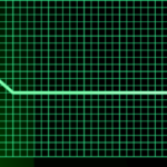 ¿Cuál es el tratamiento de la actividad eléctrica sin pulso/asistolia?